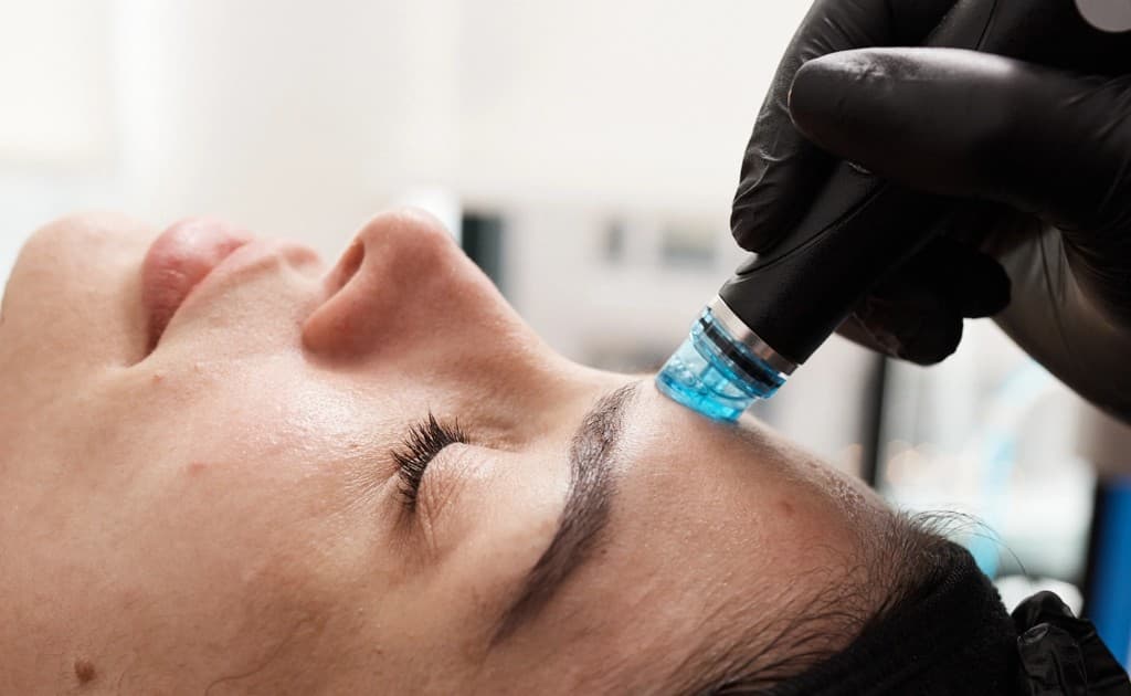 Hydrafacial treatment in progress